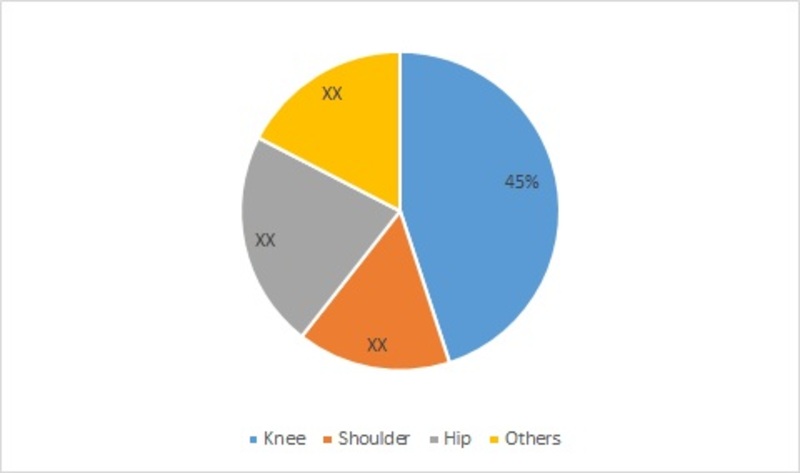 Chondroplasty Market-