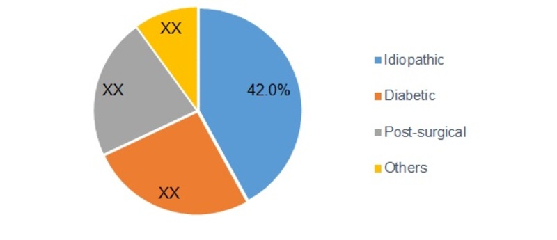 Gastroparesis Treatment Market Share