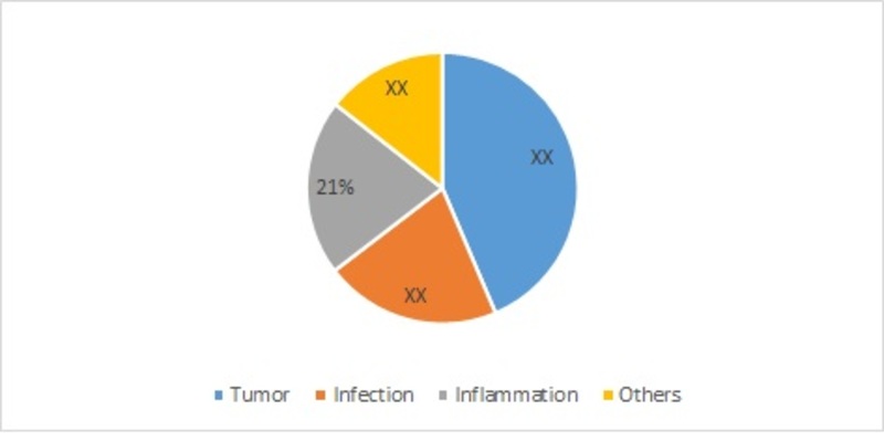 Needle Biopsy Market by Applications, 2016 