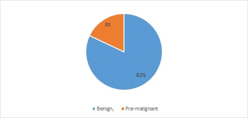 Polyps Market by Stage, 2016 